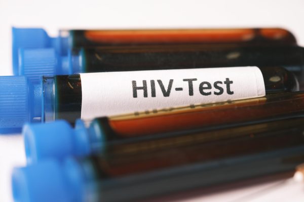 ¿Necesitas un VIH Test Rápido? Descubre las ventajas del Test Rápido de VIH de Democratest.com