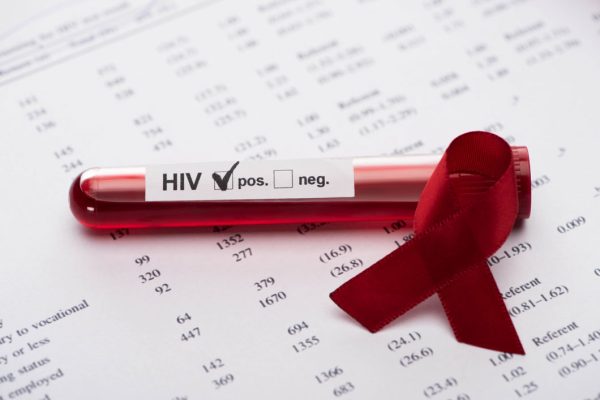 ¿Con qué frecuencia debería hacerme pruebas ETS del virus de inmunodeficiencia humana (VIH?
