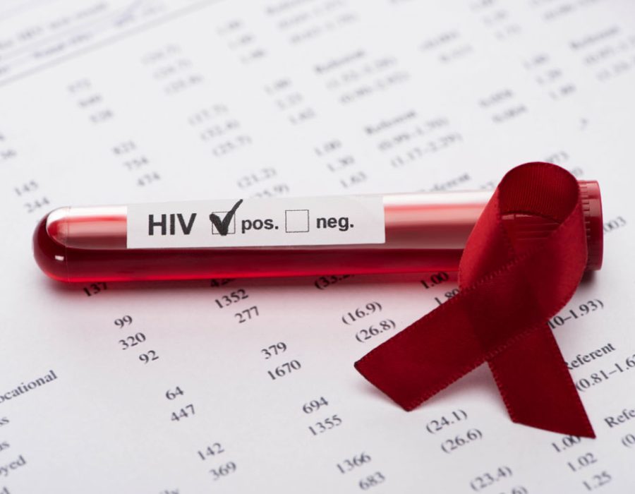 ¿Con qué frecuencia debería hacerme pruebas ETS del virus de inmunodeficiencia humana (VIH?